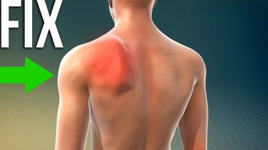 How To Fix Scapula Winging Problem