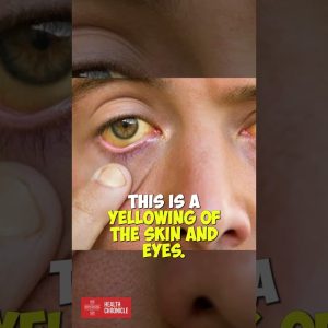 How to tell if your LIVER is working properly #sports