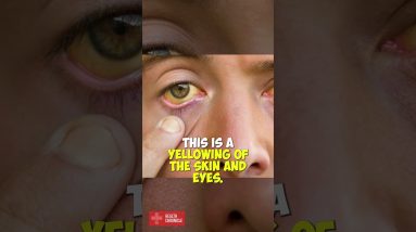 How to tell if your LIVER is working properly #sports