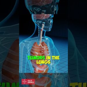 What are the dangers of TBHQ #shorts