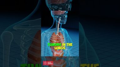 What are the dangers of TBHQ #shorts