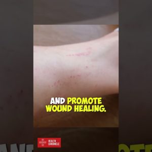 Why is MANUKA HONEY so special #shorts