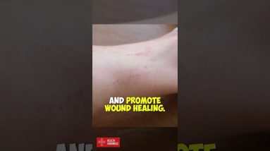 Why is MANUKA HONEY so special #shorts