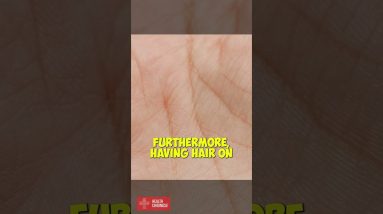 Why Do We Not Have Hair On Our Palms  #shorts