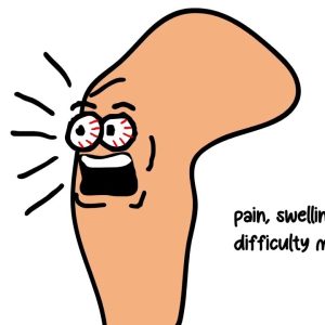 5 Different Types of KNEE PAIN