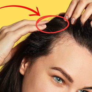 8 steps to PREVENTING Premature GREY HAIR