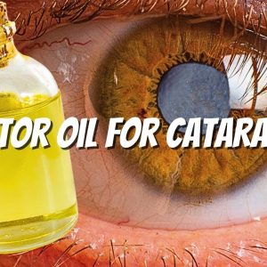 Castor Oil for Cataracts : Can YOU use it ?