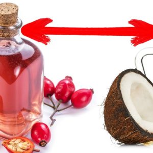 "Castor Oil vs. Other Oils: Battle of the Beauty Boosters!"