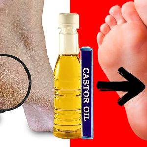 From Hair to Heels: Castor Oil's Top 5 Beauty Hacks!