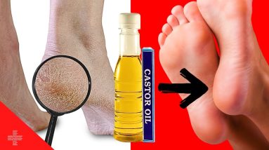 From Hair to Heels: Castor Oil's Top 5 Beauty Hacks!