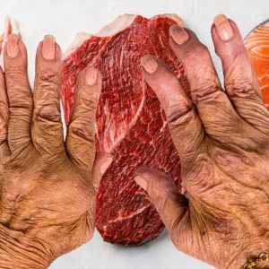 Foods to Avoid Over 50 If You Have Arthritis