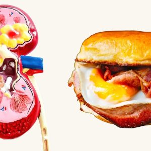 10 Foods To Avoid For Kidney Health