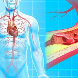 5 everyday habits that clog arteries and how to break them