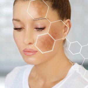 10 Surprising Causes of Age Spots and How to Prevent Them