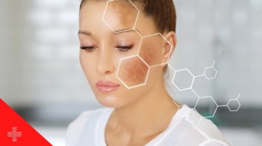 10 Surprising Causes of Age Spots and How to Prevent Them