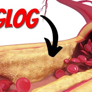 12 Foods To UNCLOG Your Arteries