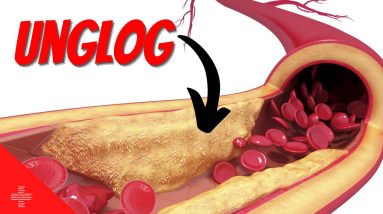 12 Foods To UNCLOG Your Arteries