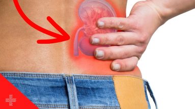 All You Need to Know About Kidney Stones