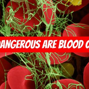 How DANGEROUS Is A BLOOD CLOT 🩸