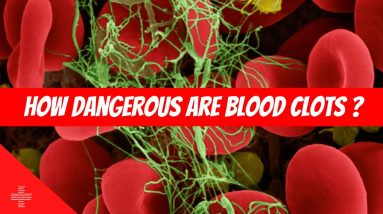 How DANGEROUS Is A BLOOD CLOT 🩸