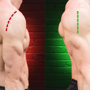 How I Fixed Rounded Shoulders Forever
