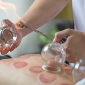 I Tried Traditional Chinese Medicine For A Week