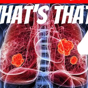 What Causes Blood Clots in Lungs ?