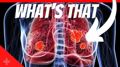 What Causes Blood Clots in Lungs ?