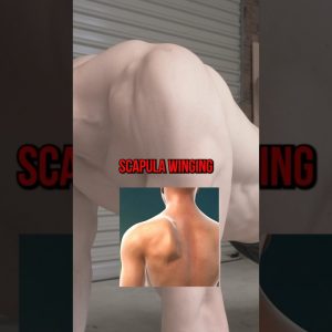 How To Fix Scapula Winging