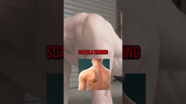How To Fix Scapula Winging